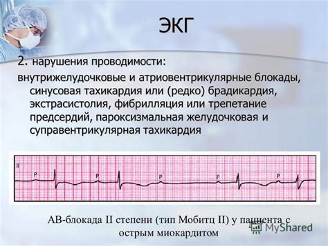 Какие симптомы указывают на нарушение проводимости сердца у ребенка?