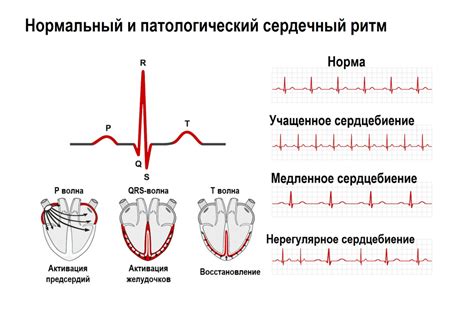 Каково значение слышать свое сердцебиение?