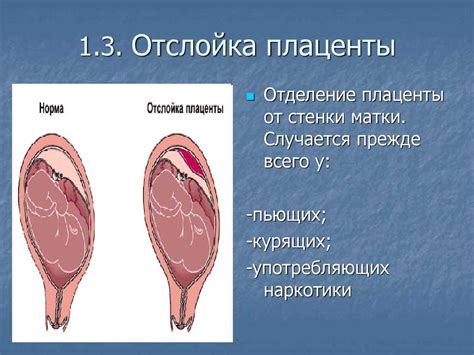 Каковы последствия плаценты 3 сосуда?