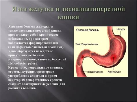 Каковы причины аспирации содержимого желудка?