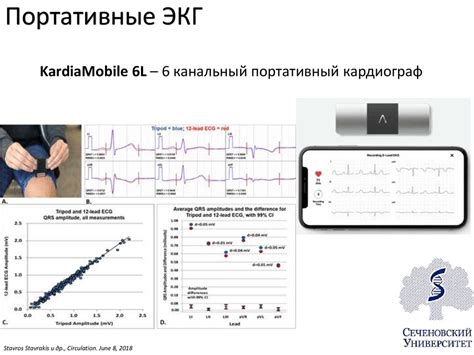 Каковы прогнозы для пациентов без синусового ритма сердца?