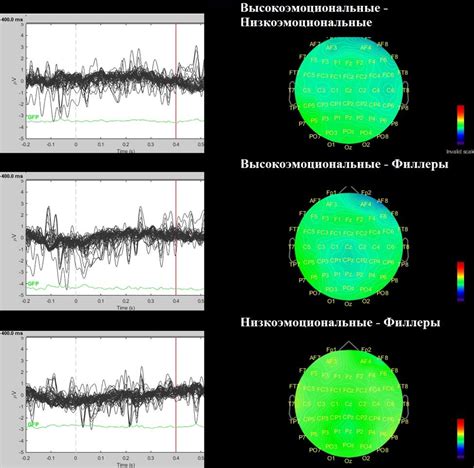 Какую роль играет пар в сауне