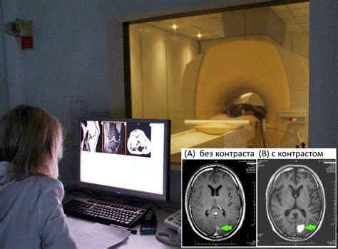 Как внутривенный контраст влияет на результаты МРТ?