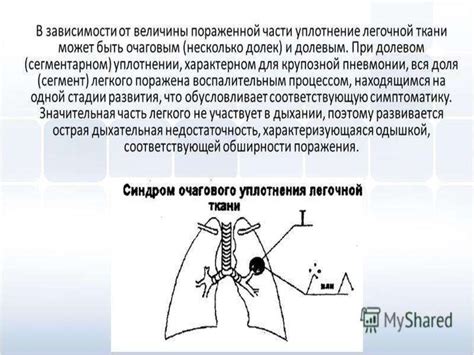 Как восстановить пневматизацию легочной ткани