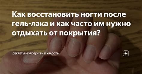 Как восстановить структуру ногтя после выпадения