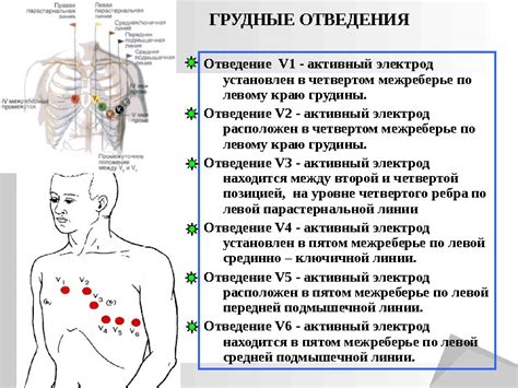 Как выбрать правильный режектор для ЭКГ