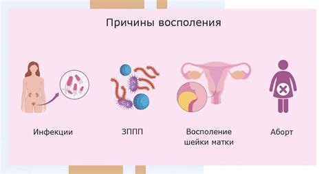 Как диагностировать оофорит справа?