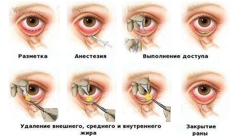 Как избежать горелого глаза