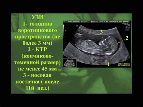 Как измеряется толщина воротникового пространства?