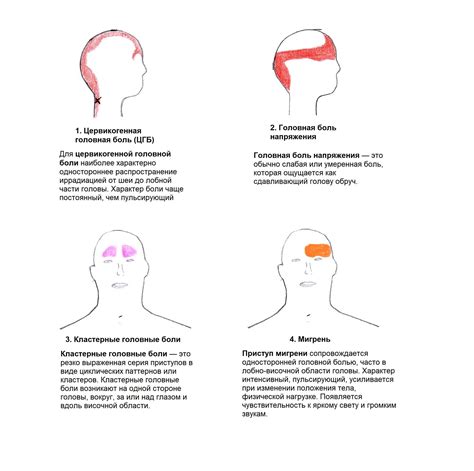 Как использовать Нимотоп для лечения головной боли