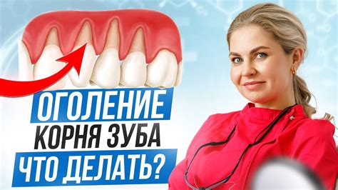 Как лечить припухшие десны?