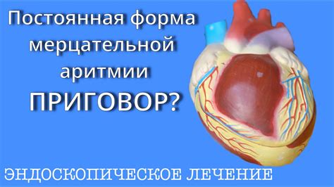 Как можно лечить постоянную икоту?