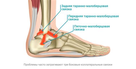 Как можно предотвратить субтотальное повреждение связки?