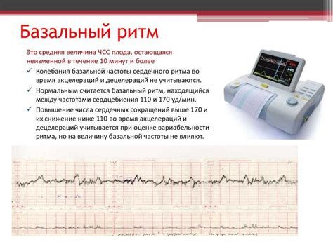 Как мониторить short term вариабельность при ктг в течение беременности