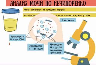 Как необходимо подготовиться к пробе с вентолином: