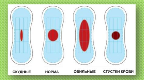 Как облегчить физические симптомы менархе