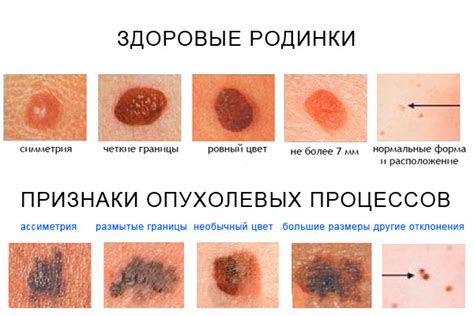 Как обнаружить метастазы: виды диагностики