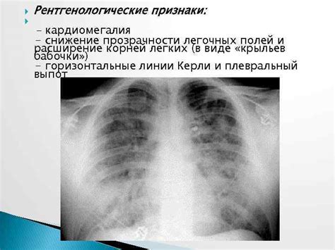 Как обогащение корней легких помогает при отравлении?