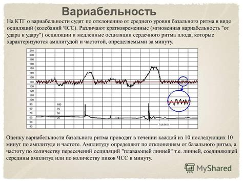 Как определить периоды активности плода по нижней линии на КТГ