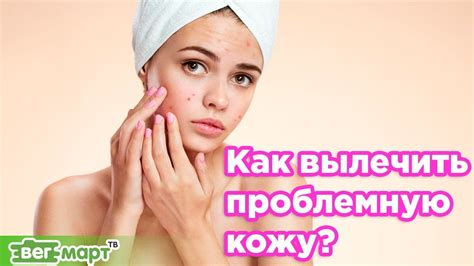 Как определить проблемную кожу