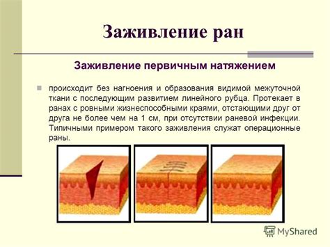 Как определить проксимальное значение раны