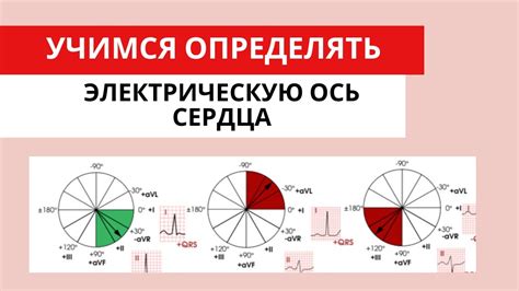 Как определить промежуточную электрическую позицию сердца у ребенка?