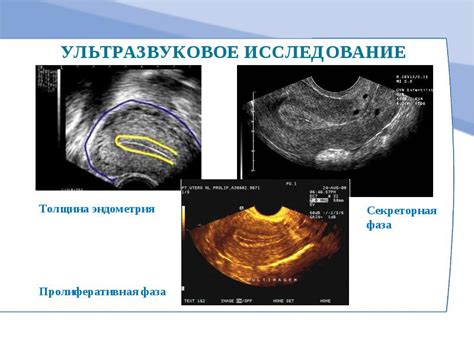 Как определить размер эндометрия