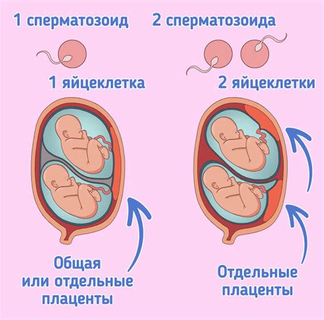 Как определить разнояйцевых детей?