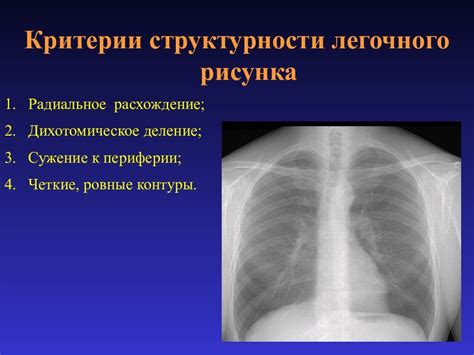 Как определить рентген признаки усиления легочного рисунка?