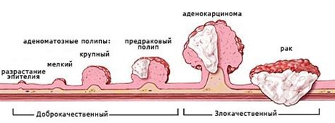 Как определить солидное строение опухоли?