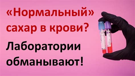 Как определяется нормальный риск?