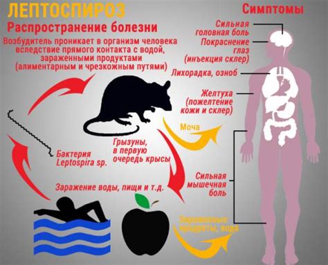 Как передается лептоспироз?