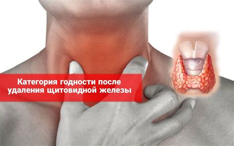 Как повысить уровень кальция после удаления щитовидной железы?