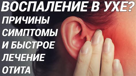 Как правильно диагностировать отит доперфоративную стадию?