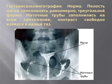 Как правильно подготовиться к УЗИ маточных труб