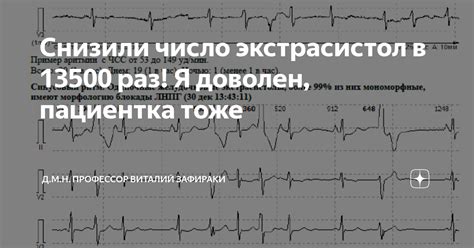 Как предотвратить появление парных экстрасистол?