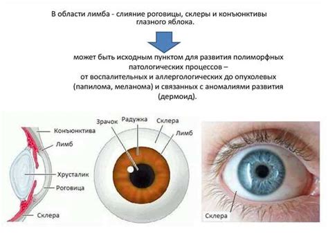 Как предотвратить развитие субиктеричного склеры