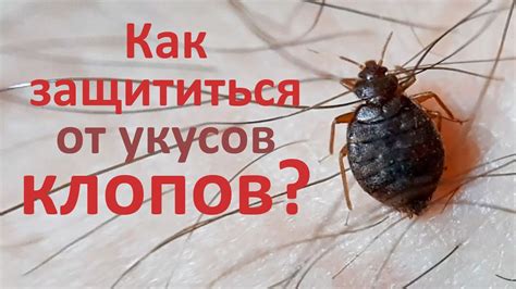 Как преодолеть отрицательные последствия видения большого числа клопов во время сна: практические советы