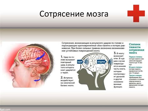 Как провести первую помощь при закрытой черепно-мозговой травме?