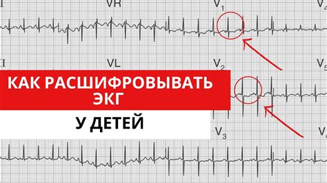 Как проводится ЭКГ в вертикальном положении у ребенка?