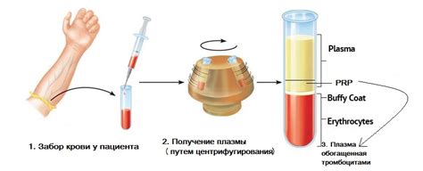 Как проводится гепариновая терапия