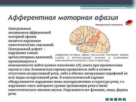 Как проводится диагностика моторной афазии