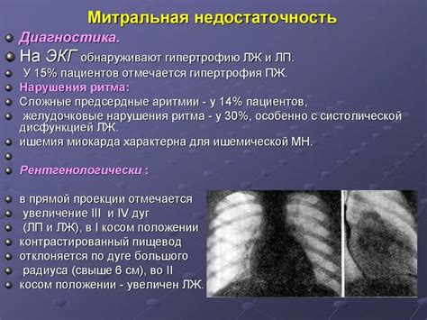 Как проводится диагностика регургитации физиологической?