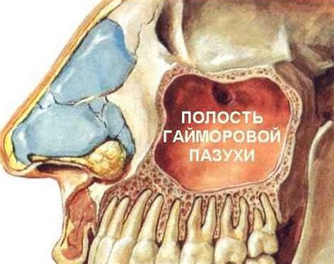 Как проводится лечение отека гайморовых пазух?