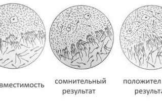 Как проводится проба шуварского?