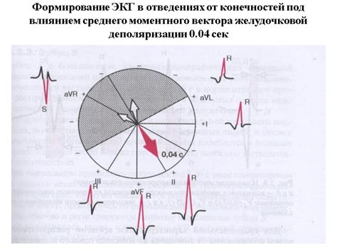 Как происходит диагностика низкоамплитудной ЭКГ от конечностей?