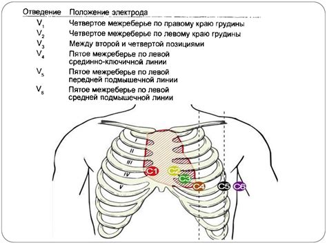 Как происходит измерение смещения грудных электродов