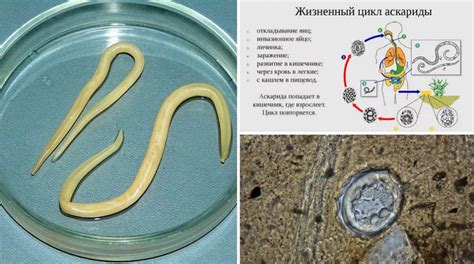 Как происходит инвазия паразита