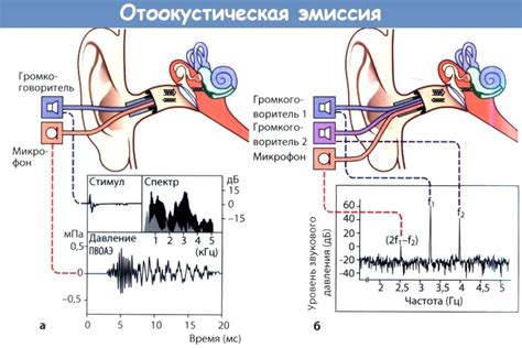 Как происходит отоакустическая эмиссия?