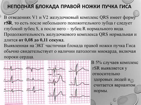 Как происходит процесс восстановления после лечения неполной блокады ПНПГ при ЭКГ у ребенка?